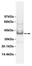 SDS-PAGE (TYK2-253H).jpg